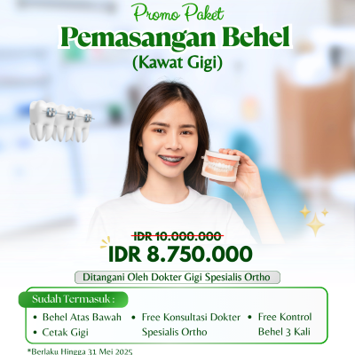 Pemasangan behel (kawat gigi)