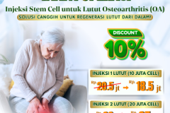 Injeksi Stem Cell Lutut