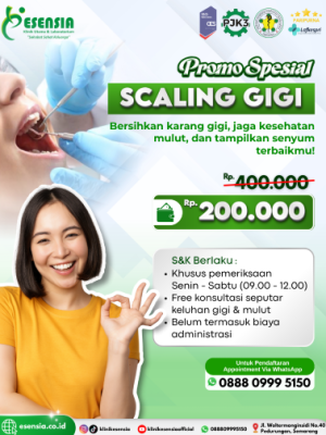 Promo Scaling Gigi
