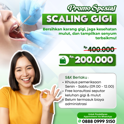 Promo Scaling Gigi
