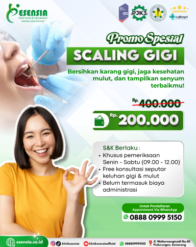 Promo Scaling Gigi