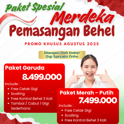 Paket Spesial Pasang Behel
