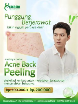 Insecure Karena Jerawat Punggung?